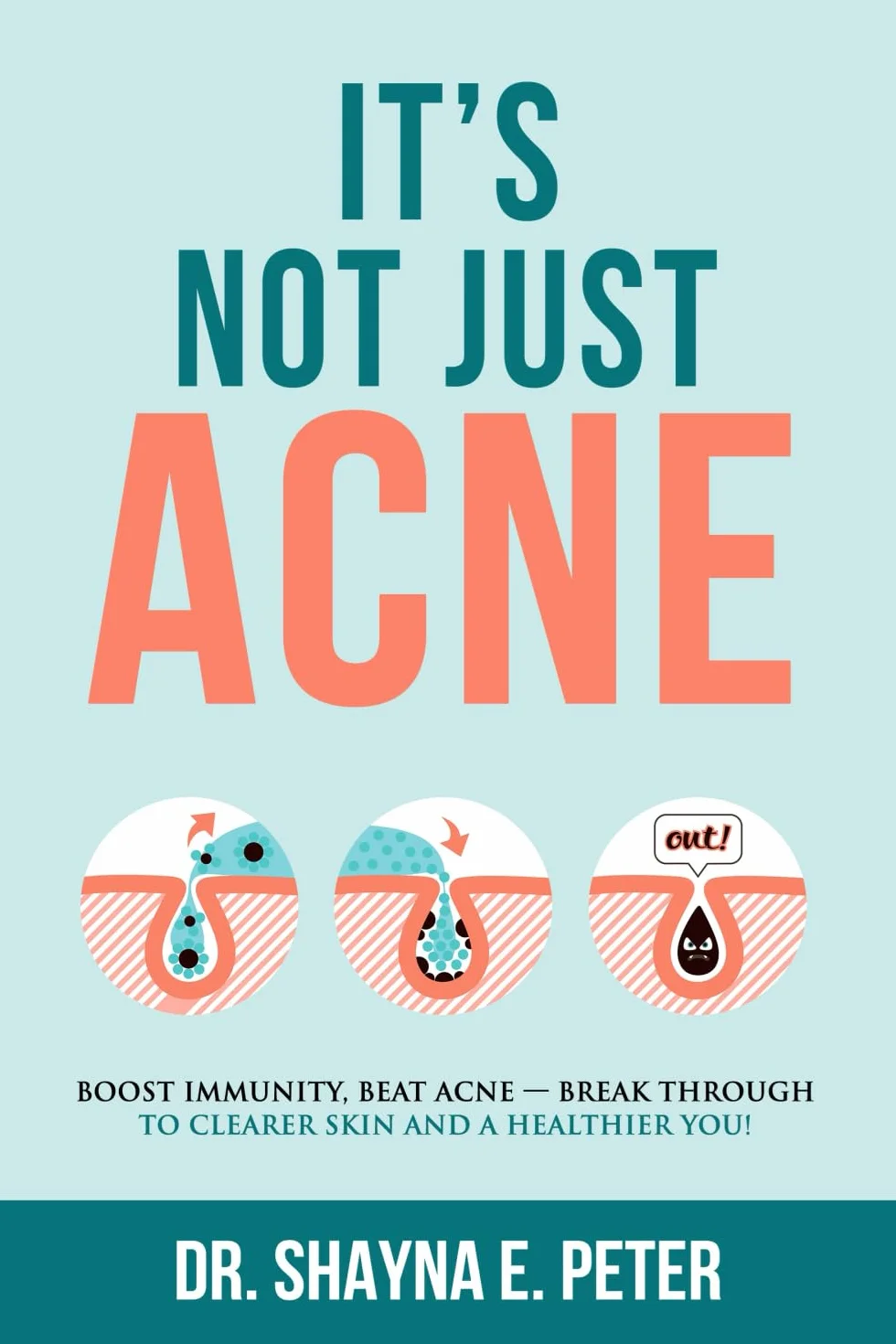 It's Not Just Acne: Boost Immunity, Beat Acne - Break Through to Clearer Skin & A Healthier You!