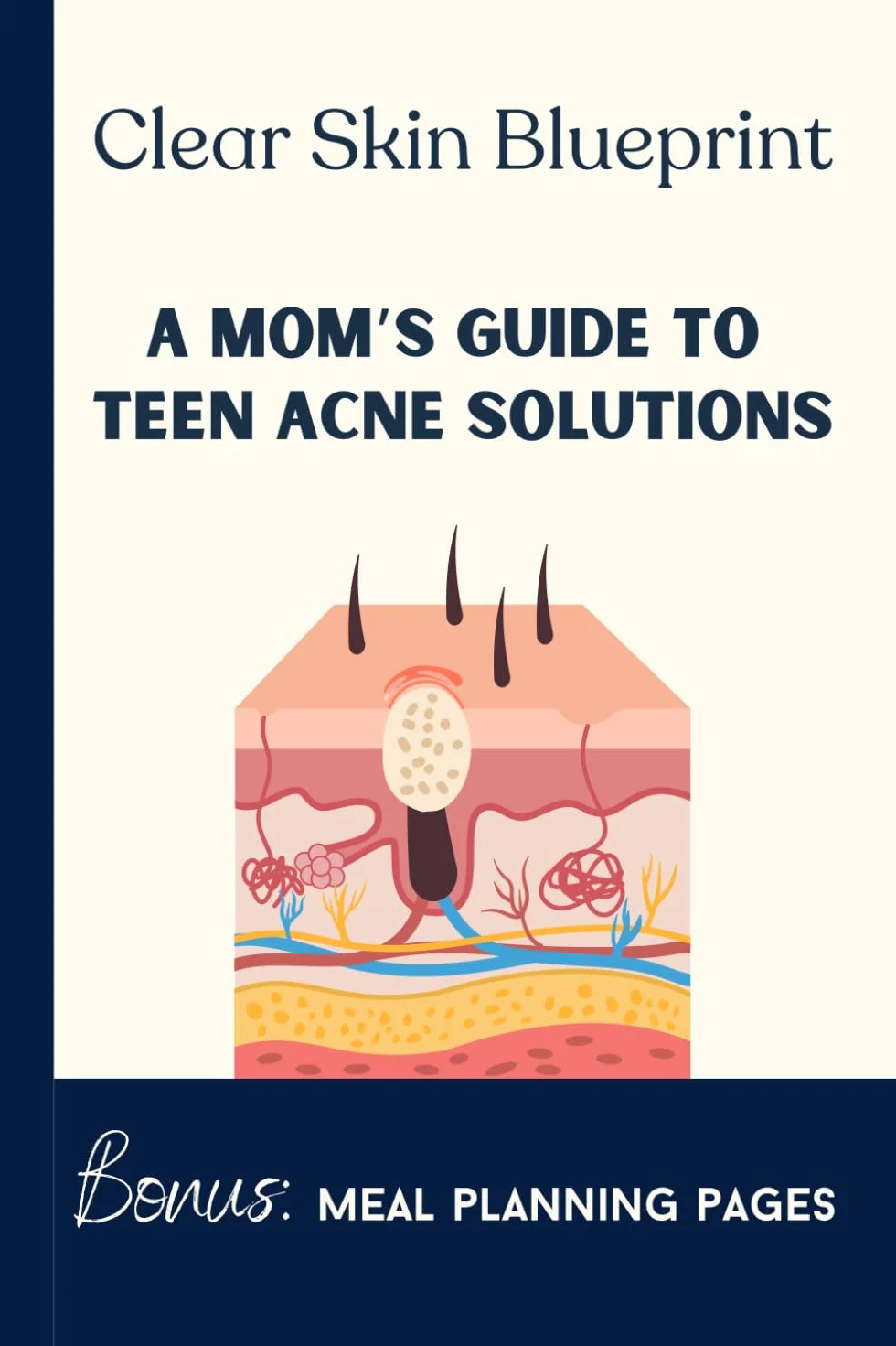 Clear Skin Blueprint: A Mom's Guide To Teen Acne Solutions