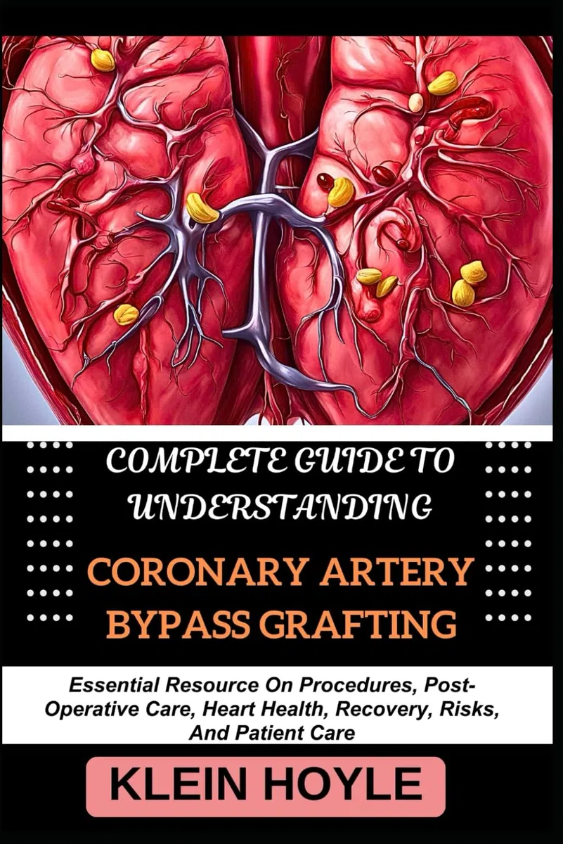 COMPLETE GUIDE TO UNDERSTANDING CORONARY ARTERY BYPASS GRAFTING: Essential Resource On Procedures, Post-Operative Care, Heart Health, Recovery, Risks, And Patient Care